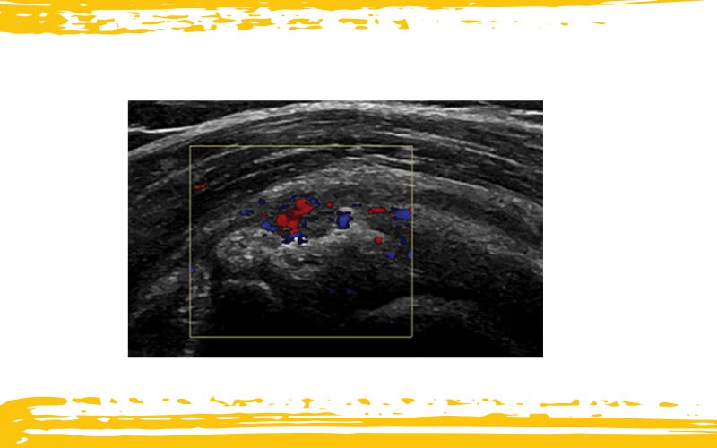 Calficiacion tempo formacion 2.jpg
